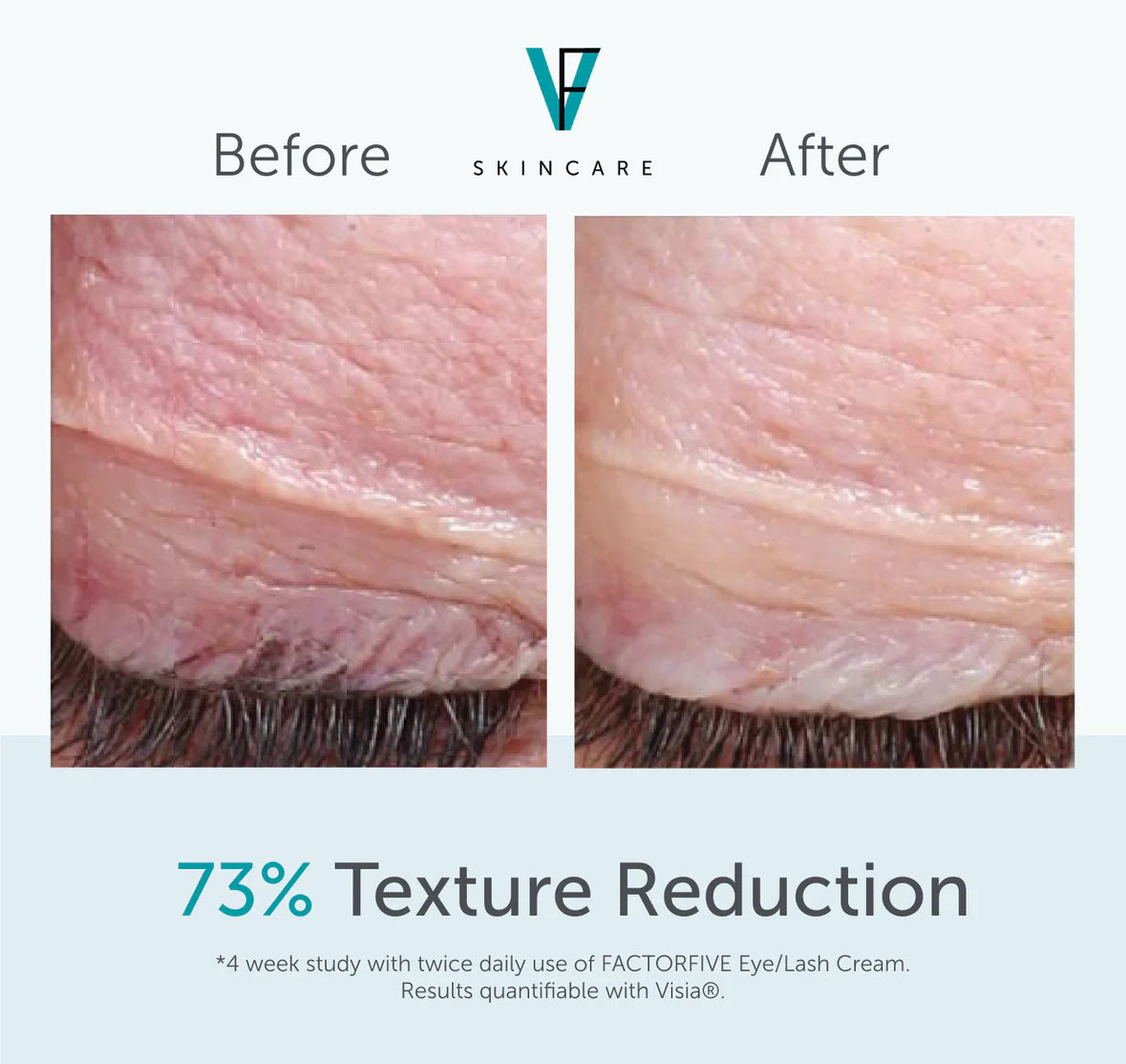 FactorFive Eye/Lash Cream